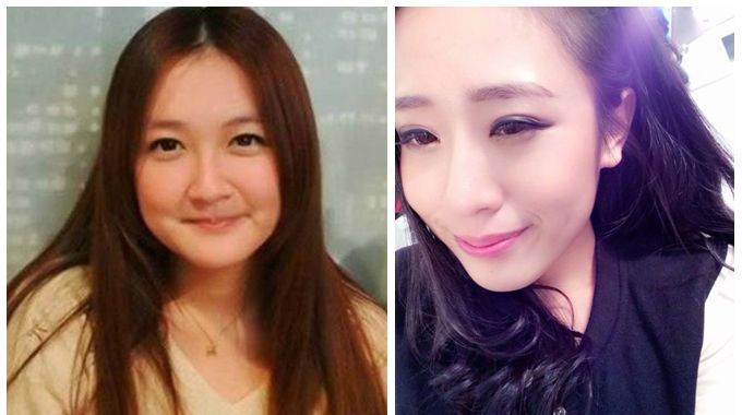 超雅医疗美容研究所,遇见你是我的幸运935 超雅医疗美容研究所,遇见你是我的幸运935