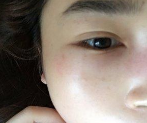 超声波去眼袋是个什么梗?我来说说吧。829 超声波去眼袋是个什么梗?我来说说吧。829