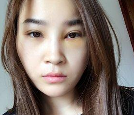 超声波去眼袋是个什么梗?我来说说吧。829 超声波去眼袋是个什么梗?我来说说吧。829