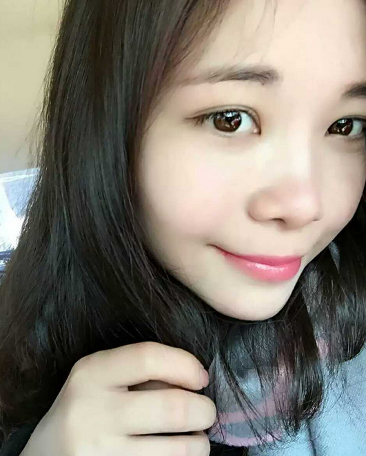 赶走wǒ得眼袋黑眼圈全靠超 声 波去眼袋 赶走wǒ得眼袋黑眼圈全靠超 声 波去眼袋