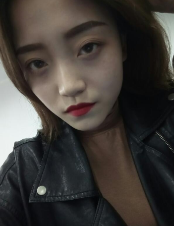 超声波去眼袋告别伴随我一年的眼袋058 超声波去眼袋告别伴随我一年的眼袋058