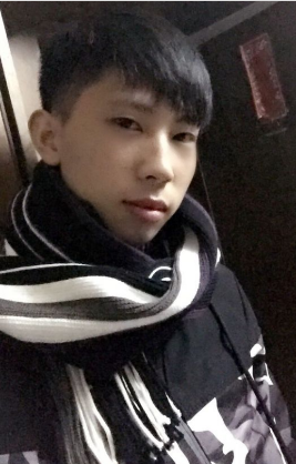 超 声 波去眼袋 女朋友不再折腾wǒ 超 声 波去眼袋 女朋友不再折腾wǒ