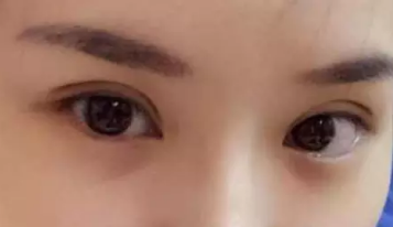 女性自由的选择美丽可以来超雅做超声波双眼皮098 女性自由的选择美丽可以来超雅做超声波双眼皮098