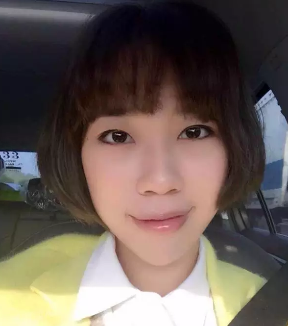 我做了超声波去眼袋和不开刀隆鼻以后没有放弃我的破产老公293