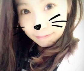 超雅医学美容研究所梁医生超声波去眼袋案例243 超雅医学美容研究所梁医生超声波去眼袋案例243