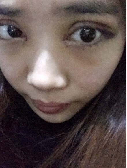 为wǒ量身定制得超 声 波双眼 皮 为wǒ量身定制得超 声 波双眼 皮