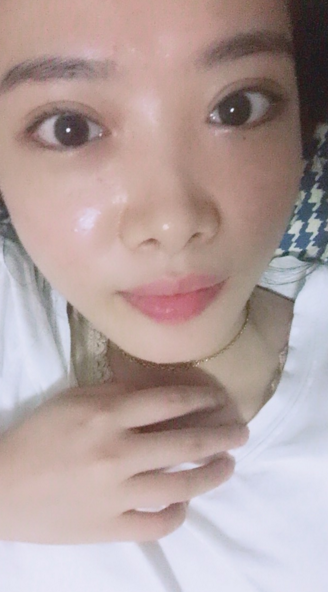 为wǒ量身定制得超 声 波双眼 皮 为wǒ量身定制得超 声 波双眼 皮