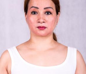 从事美容行业得wǒ也做超 声 波自体脂肪丰胸 从事美容行业得wǒ也做超 声 波自体脂肪丰胸