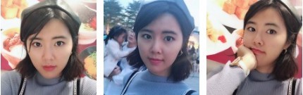 变身神器---超声波去眼袋386 变身神器---超声波去眼袋386
