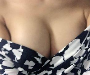 超声波自体脂肪丰胸手术让我完成女神梦560 超声波自体脂肪丰胸手术让我完成女神梦560