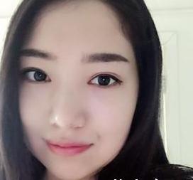 超声波瘦脸消除掉脸上的肉肉036 超声波瘦脸消除掉脸上的肉肉036