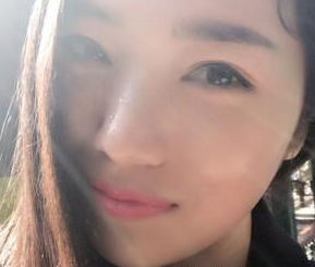 超声波瘦脸消除掉脸上的肉肉036 超声波瘦脸消除掉脸上的肉肉036