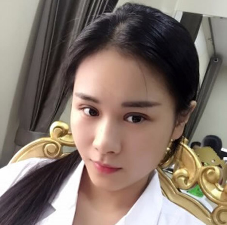 做完超声波双眼皮 小张桃花运开始了191 做完超声波双眼皮 小张桃花运开始了191