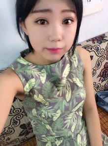 超 声 波双眼 皮打造完美弧度 超 声 波双眼 皮打造完美弧度