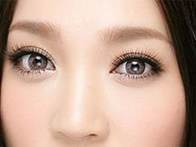 我的祛眼袋妙招超声波祛眼袋641 我的祛眼袋妙招超声波祛眼袋641
