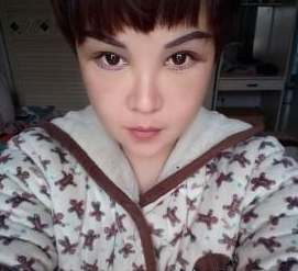 超声波去眼袋的手术效果真的挺好的,分享677 超声波去眼袋的手术效果真的挺好的,分享677