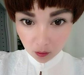 超声波去眼袋的手术效果真的挺好的,分享677 超声波去眼袋的手术效果真的挺好的,分享677