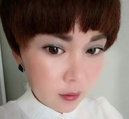 还是喜欢没有眼袋的自己——超声波去眼袋481 还是喜欢没有眼袋的自己——超声波去眼袋481