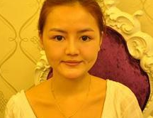 亲戚介绍去做超 声 波去眼袋,结果不错呢 亲戚介绍去做超 声 波去眼袋,结果不错呢