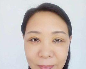 经历超声波去眼袋手术,说说情况吧256 经历超声波去眼袋手术,说说情况吧256