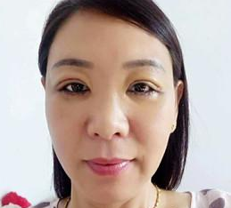 经历超声波去眼袋手术,说说情况吧256 经历超声波去眼袋手术,说说情况吧256