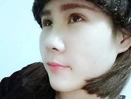 做le个超 声 波双眼 皮手术，再也不shì刻薄之眼le