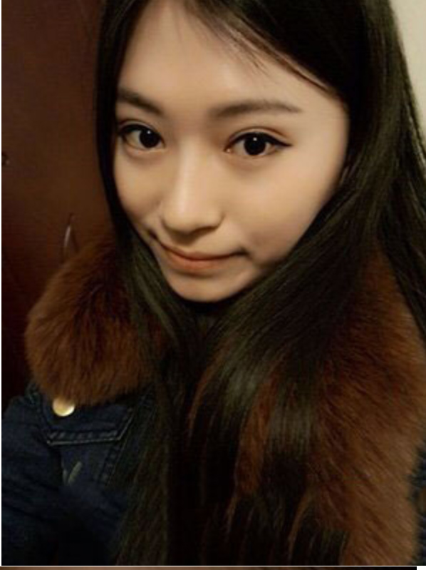 超声波双眼皮让我变的美丽出众511 超声波双眼皮让我变的美丽出众511