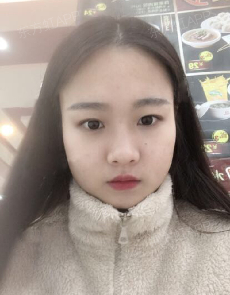 做了超声波瘦脸以后,我的颜值大大的提高了612 做了超声波瘦脸以后,我的颜值大大的提高了612