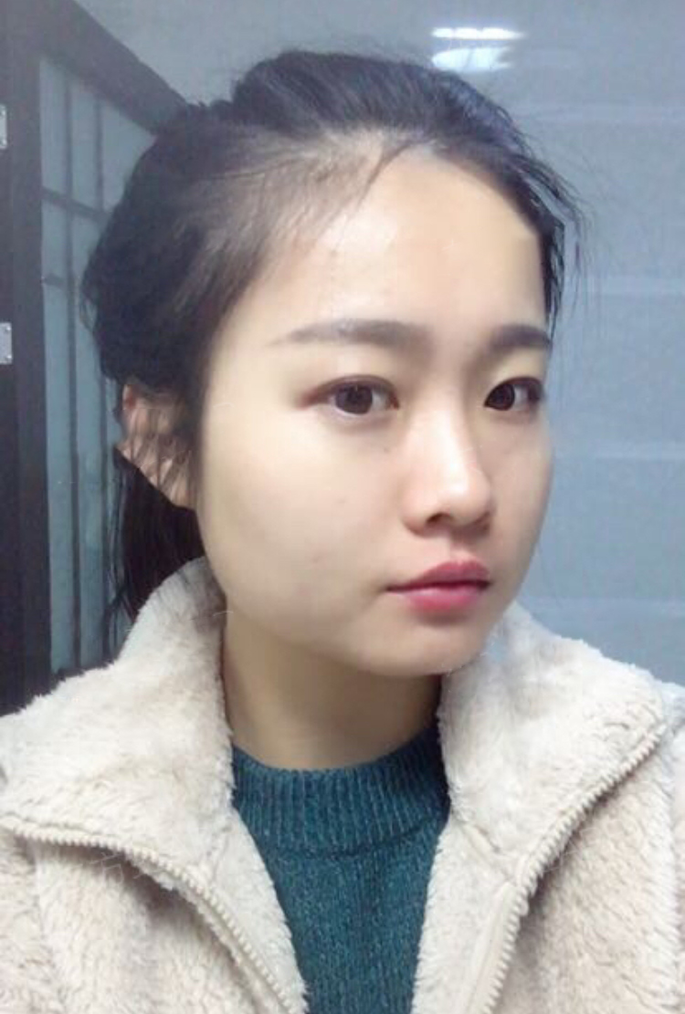 做了超声波瘦脸以后,我的颜值大大的提高了612 做了超声波瘦脸以后,我的颜值大大的提高了612