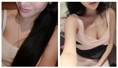 小胸妹子的福音超声波自体脂肪丰胸409 小胸妹子的福音超声波自体脂肪丰胸409
