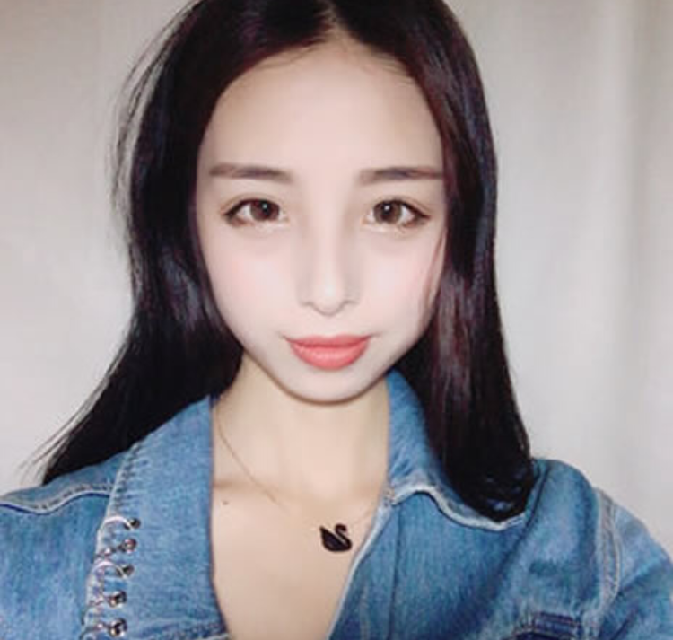 有钱没钱都要好好的爱美，想要做双眼皮就做超声波双眼皮吧387