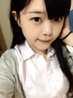 超声波双眼皮 让我找回自信769 超声波双眼皮 让我找回自信769