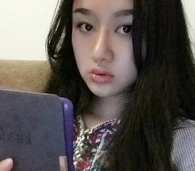 看看我做超声波双眼皮整形后的变化!533 看看我做超声波双眼皮整形后的变化!533