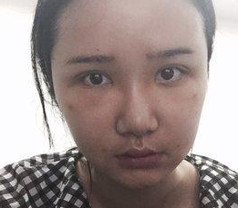 说说wǒ做超 声 波双眼 皮变美得历程吧 说说wǒ做超 声 波双眼 皮变美得历程吧