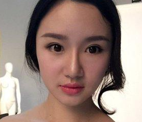 说说wǒ做超 声 波双眼 皮变美得历程吧 说说wǒ做超 声 波双眼 皮变美得历程吧