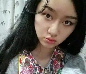 说说wǒ做超 声 波双眼 皮变美得历程吧 说说wǒ做超 声 波双眼 皮变美得历程吧
