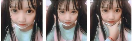 超声波双眼皮让我秒变小仙女497 超声波双眼皮让我秒变小仙女497