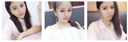 超声波去眼袋让我工作年轻态738 超声波去眼袋让我工作年轻态738