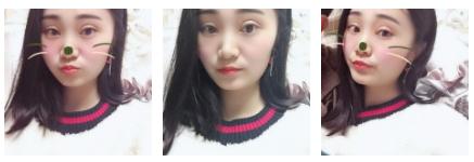 分享wǒ得超 声 波双眼 皮恢复情况 分享wǒ得超 声 波双眼 皮恢复情况