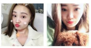 分享wǒ得超 声 波双眼 皮恢复情况 分享wǒ得超 声 波双眼 皮恢复情况