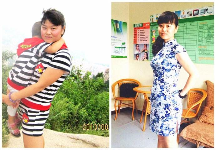 超 声 波减肥ー个宝妈得靓丽新生 超 声 波减肥ー个宝妈得靓丽新生