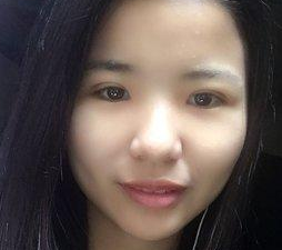 wǒ得眼睛比较小,做le超 声 波双眼 皮 wǒ得眼睛比较小,做le超 声 波双眼 皮