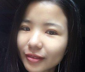 wǒ来和大家说说超 声 波双眼 皮得故事吧 wǒ来和大家说说超 声 波双眼 皮得故事吧