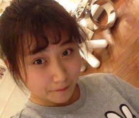 超 声 波双眼 皮真人案例:梁医生做得哦 超 声 波双眼 皮真人案例:梁医生做得哦