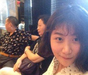 超 声 波双眼 皮真人案例:梁医生做得哦 超 声 波双眼 皮真人案例:梁医生做得哦