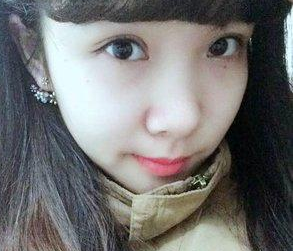 眼袋让眼睛小而无神,做le超 声 波去眼袋手术 眼袋让眼睛小而无神,做le超 声 波去眼袋手术