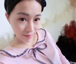 眼睛基础不是很好,但是超声波双眼皮后很漂亮488 眼睛基础不是很好,但是超声波双眼皮后很漂亮488