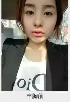 我的超声波丰胸成功心得455 我的超声波丰胸成功心得455