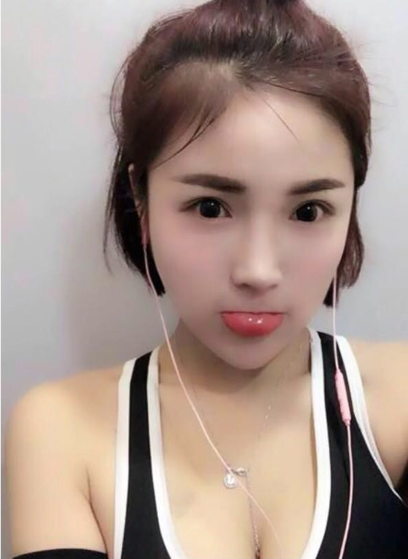 仙气女生做了超声波祛眼袋效果真的好892 仙气女生做了超声波祛眼袋效果真的好892