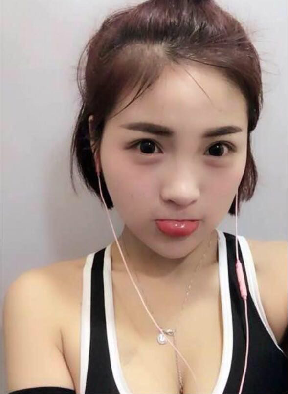 仙气女生做了超声波祛眼袋效果真的好892 仙气女生做了超声波祛眼袋效果真的好892